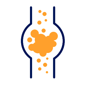 Thrombosis (blood clots)