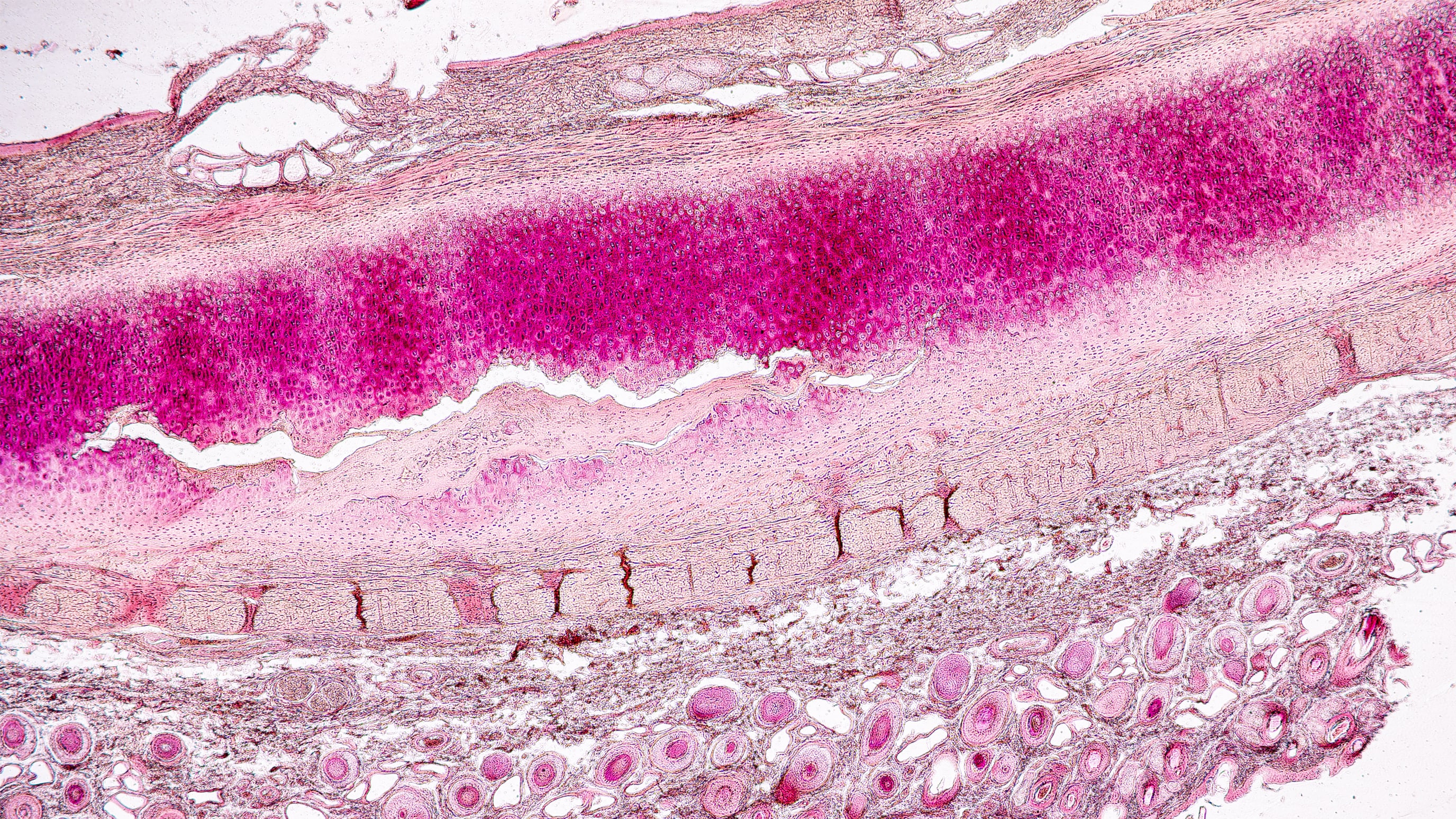 Bone Metabolism